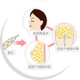 深圳自体脂肪移植