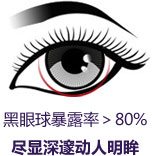 芭比翘睫美瞳术