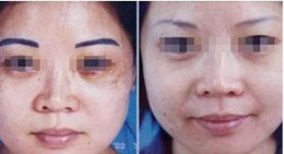 深圳哪些洗眉方法是不可取的?