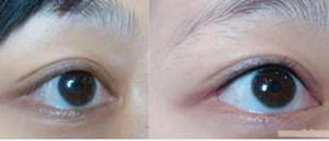 深圳纹眼线需要多少钱呢?